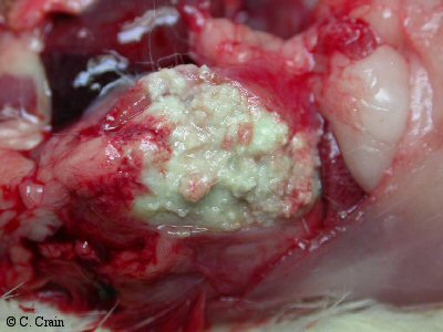abscessed lung