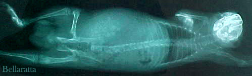 bladder X-ray 1