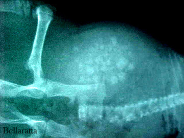 bladder X-ray 2