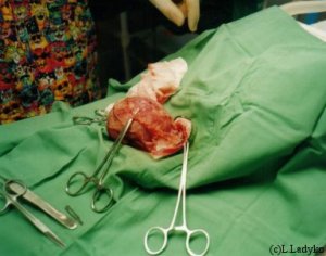 pus-filled uterus