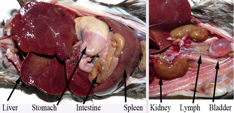 granulocyctic leukemia