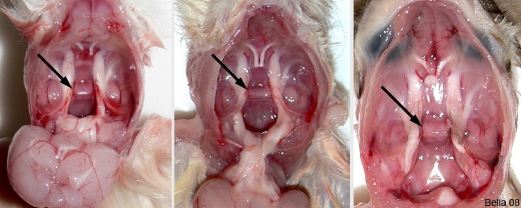 Pituitary Tumors