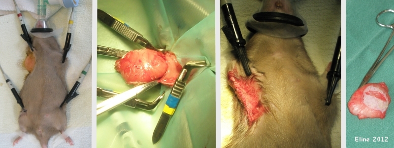 mammary tumor removal